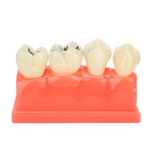 Model dentar pentru educație, manoperă fină, combină cunoștințele de bază cu predarea practică