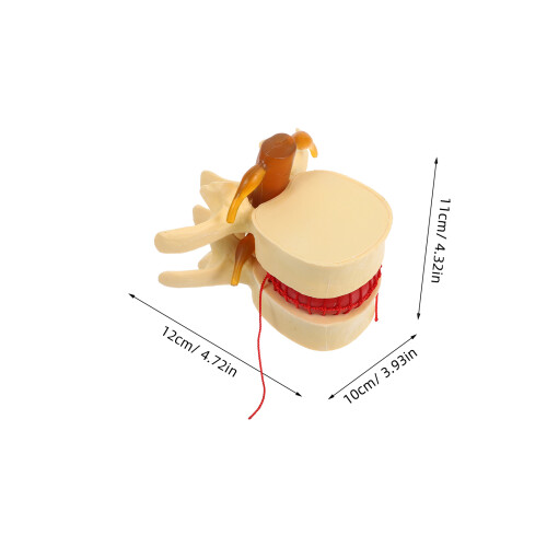 Khaki PVC Herniated Disc Spine Model Enlarged for Anatomy Study 1