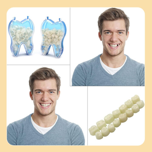 Tooth  Kit 100PCS Temporary Dental Crowns Multiple Sizes with Storage Box for Front and Molar 1