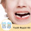 Tooth  Kit 100PCS Temporary Dental Crowns Multiple Sizes with Storage Box for Front and Molar 5
