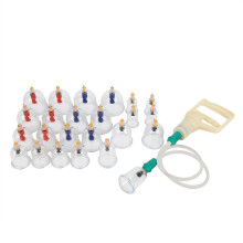 Chinese vacuümcuppingset met U-vormige cups en magneettherapie, biomagnetische therapie, traditionele Chinese therapie die de bloedsomloop bevordert