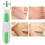 Derma Roller για αναζωογόνηση δέρματος, ευέλικτο και αξιόπιστο εργαλείο 3