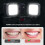 Dental Phone Photography Light Professional Lighti 4
