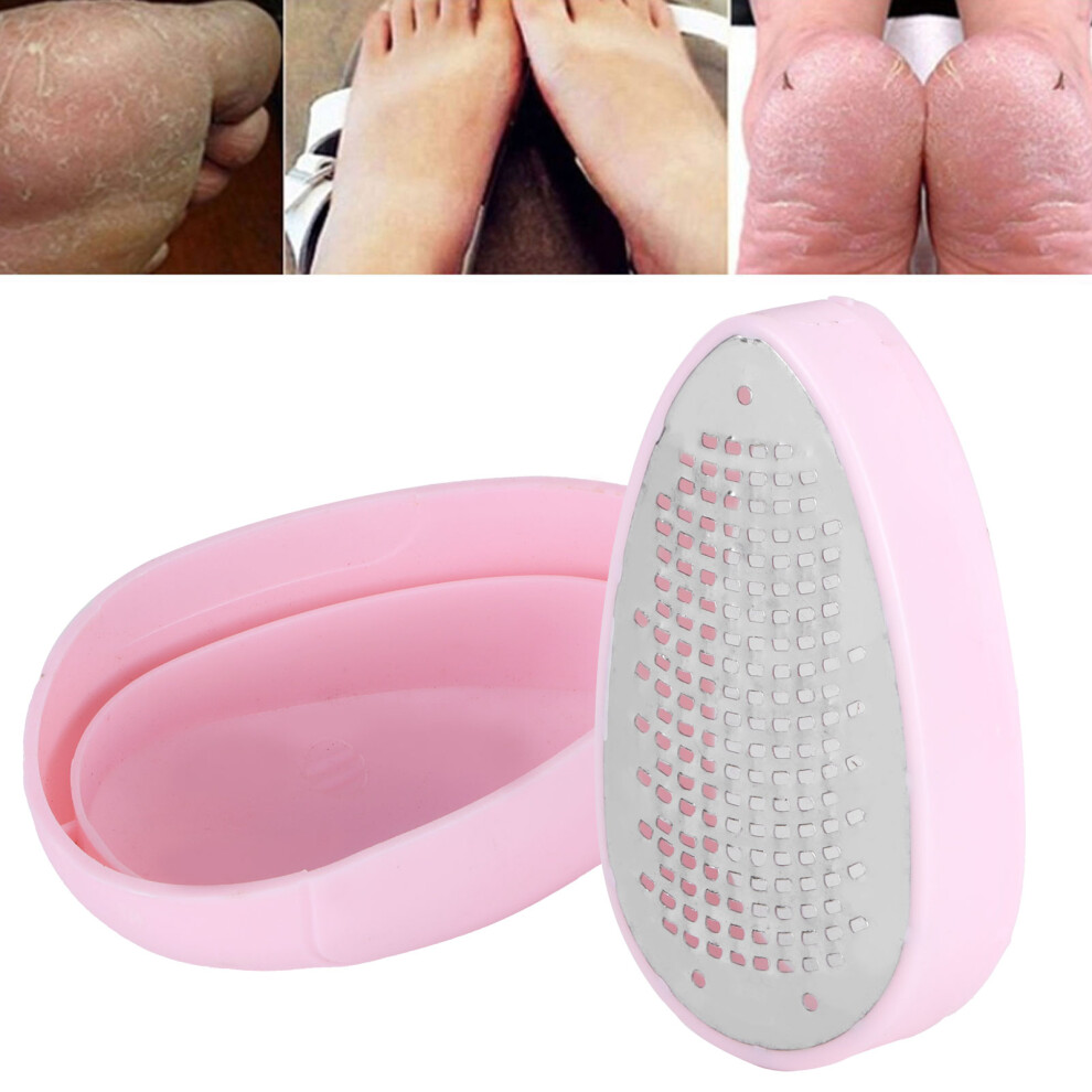 Pink Foot File Callus Remover Â Exfoliating Dead Skin, 10X6x4cm