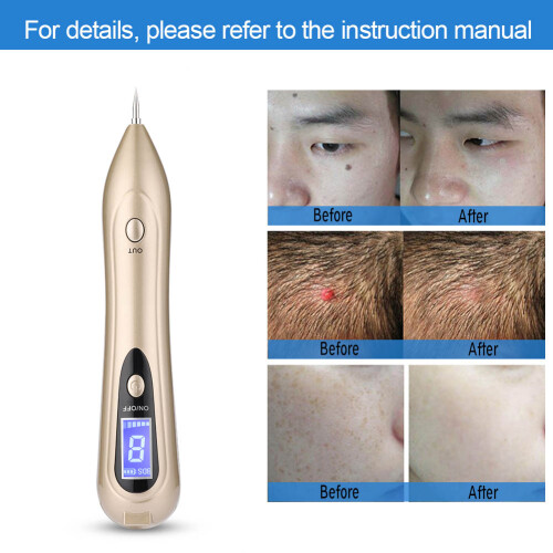 Hot Patch Technology Skin Tag Remover Pen Gentle Lifting Massage Multifunctional Replacement Tip Adjustable Strength Modes Rechargeable Handheld 2