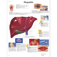 Laminated Hepatitis Anatomy Chart with Detailed Colorful Illustration for Medical Education