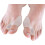 Προστατευτικά Hallux Valgus, Σετ επιθεμάτων για κάλους, ανακούφιση από τον πόνο και 1