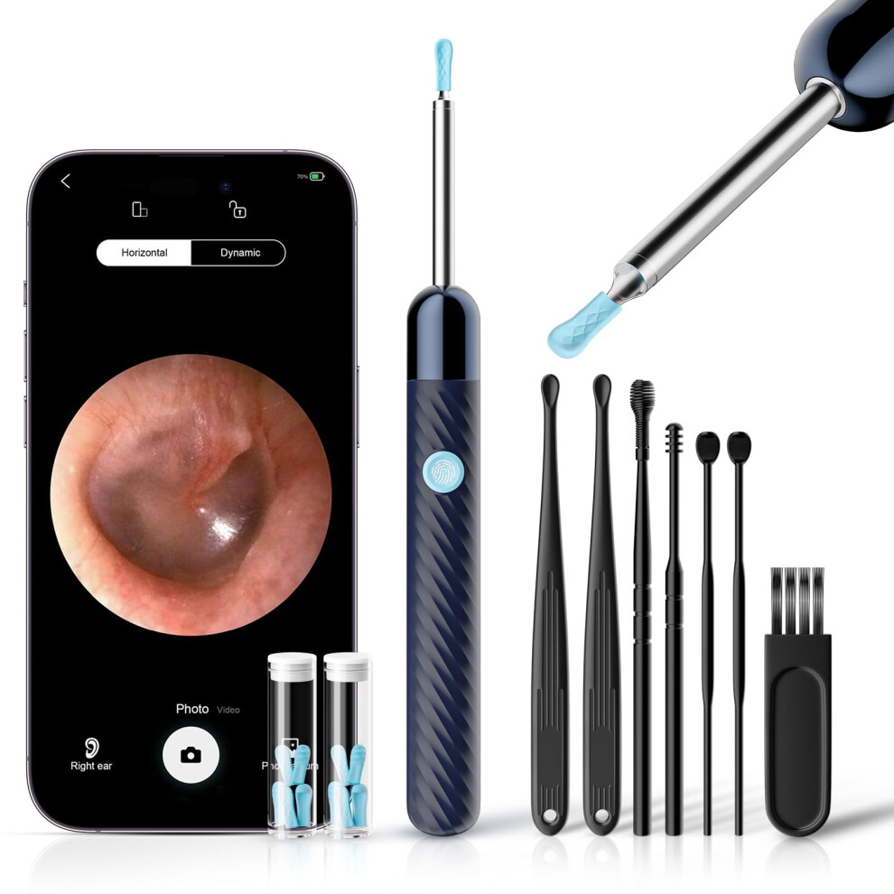 Deetok Ear Wax Removal - Earwax Remover Tool With 7 Pcs Ear Set - Ear Cleaner 1080P Hd Ear Scope - Camera With 6 Led Lights - Ear Cleanin