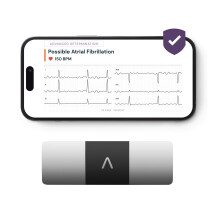 KardiaMobile 6-Lead Personal ECG Heart Rate Monitor + 1 Month Free of KardiaCare - Six Views of The Heart, Detects Atrial Fibrilla