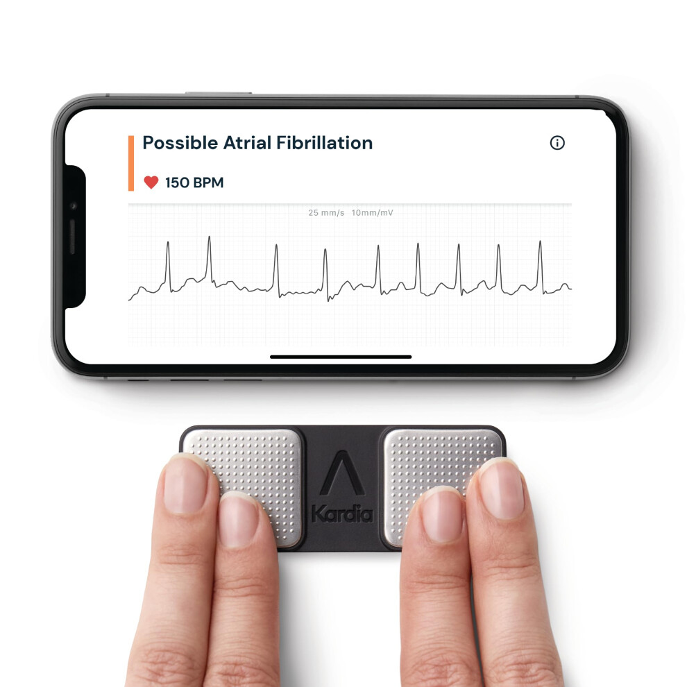 Alivecor Kardiamobile 1-Lead Personal Ecg Heart Rate Monitor - Record Ecgs At Home, Detects Atrial Fibrillation, Trusted By The Nhs, Results In 30 Seconds, Wo