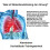 Lung trainer breathing trainer, breathing trainer, adjustable resistance, 2