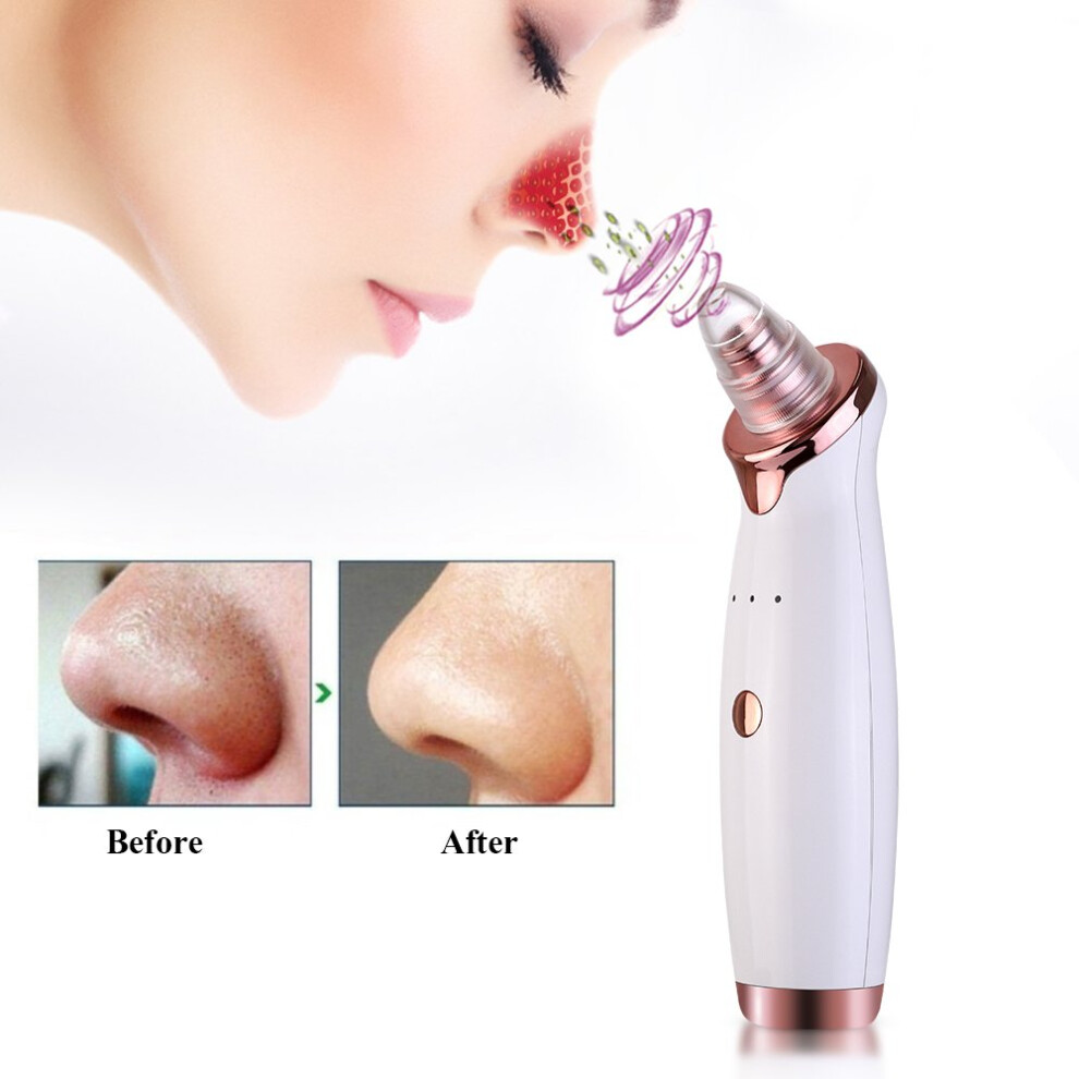 Blackhead Remover Vacuum with Diamond Microdermabrasion for Deep Pore Cleansing and Acne Care