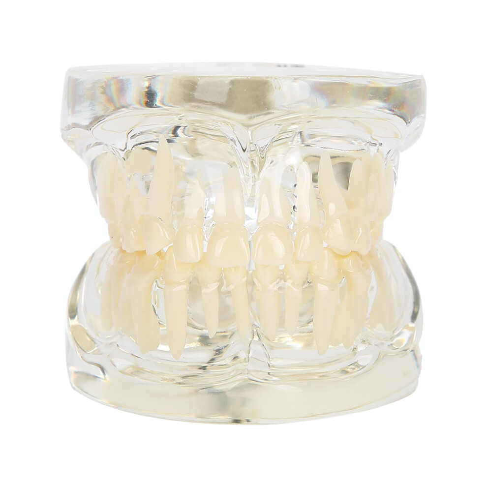 Pathological Teeth Model With Detachable Components, Visual Understanding Of Dental Structures And Pathologies For Effective Patient Education