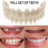 Smile Snap On False Teeth Upper Lower Dental Veneers Dentures Tooth Cover Setyj51-3 1