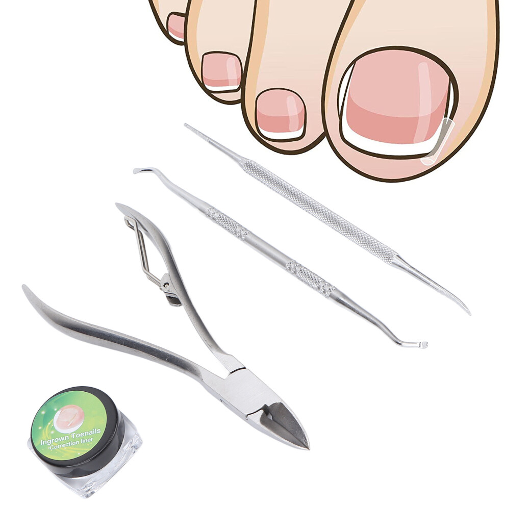 Ingrown Toenail Treatment Set: Strips Lifter Clippers & File