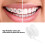 Chaîne orthodontique continue - caoutchouc transparent 2