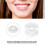 Chaîne orthodontique continue - caoutchouc transparent 4