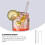 5 Sets Reusable Straws For Hot Drinks Stainless Steel Bubble Tea 9