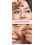 Overnight Hydrocolloid Pimple Patch Star Shape for Face Acne Blemish Reduction 200PCS 4
