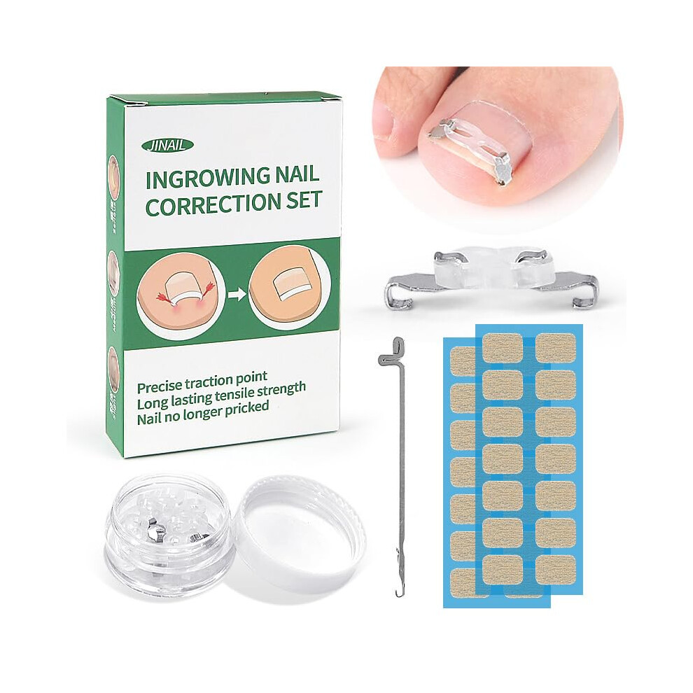 Ingrown Toenail Correction and Removal Kit, Painless Curved Nail Straightener for Home Use
