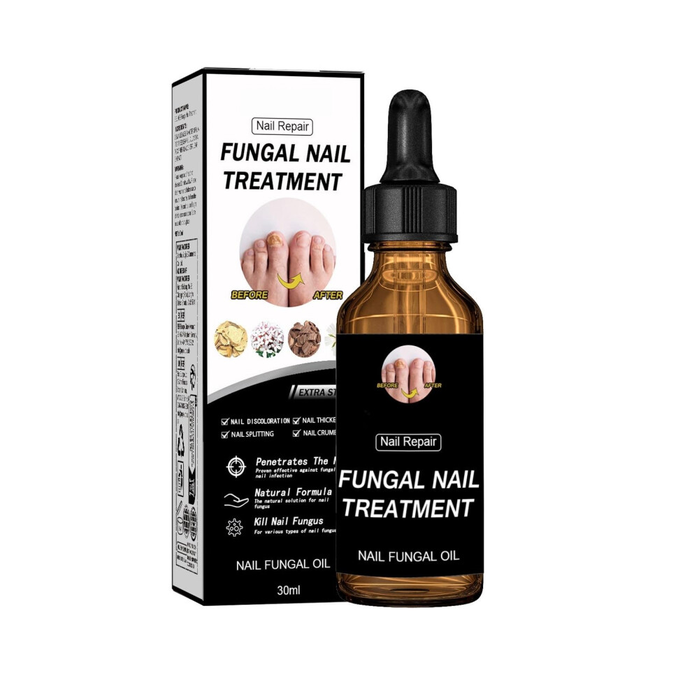 Natural Fungal Nail Treatment Oil 30ml Restores Nail Appearance for Toenail Fungus