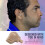 Hearing Amplifier Ear ITC (Pair) "Extra Small" Second Generation(Beige) 7