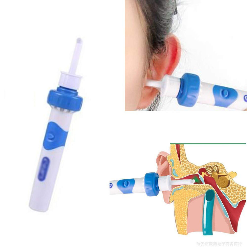 Electric Ear Wax Removal Tool with Gentle Vibration and Suction, Safe Ear Cleaning Kit for Adults and Kids