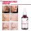 AHA BHA Απολεπιστικός Ορός για Χημικό Peeling Προσώπου, Βαθύς Καθαρισμός Πόρων, 4