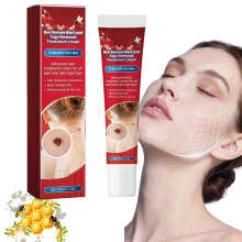 Wart and Tag Remover Cream, Fast-Acting Skin Tag & Mole Remover, Wart Removal&Tag Recede Cream, Skin Tag Remover, for Hands & Body