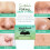 Hydrocolloid Acne Patches and Blackhead Remover Strips Value Pack for Face Nose Large Coverage 5
