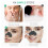 Hydrocolloid Acne Patches and Blackhead Remover Strips Value Pack for Face Nose Large Coverage 4