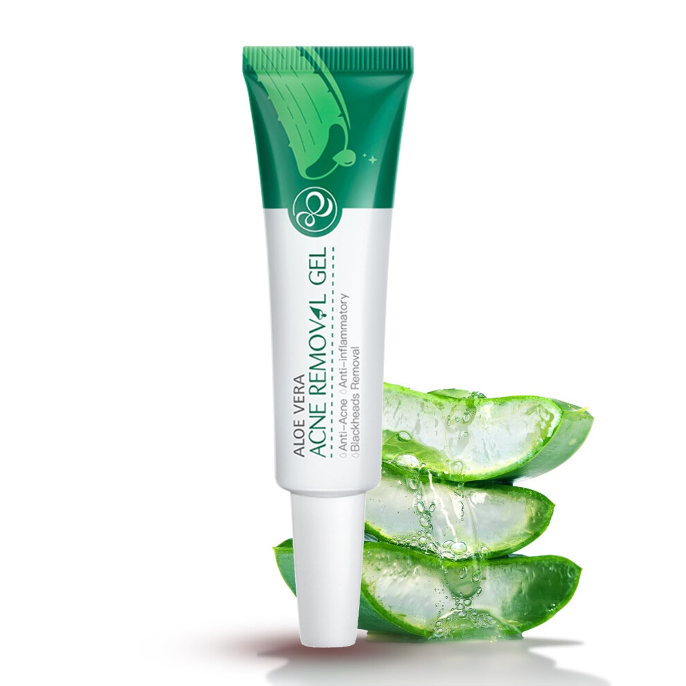 Cream Aloe Vera Anti Acne Face For Oily Skin, Day And Night Moisturizer Soothes Redness