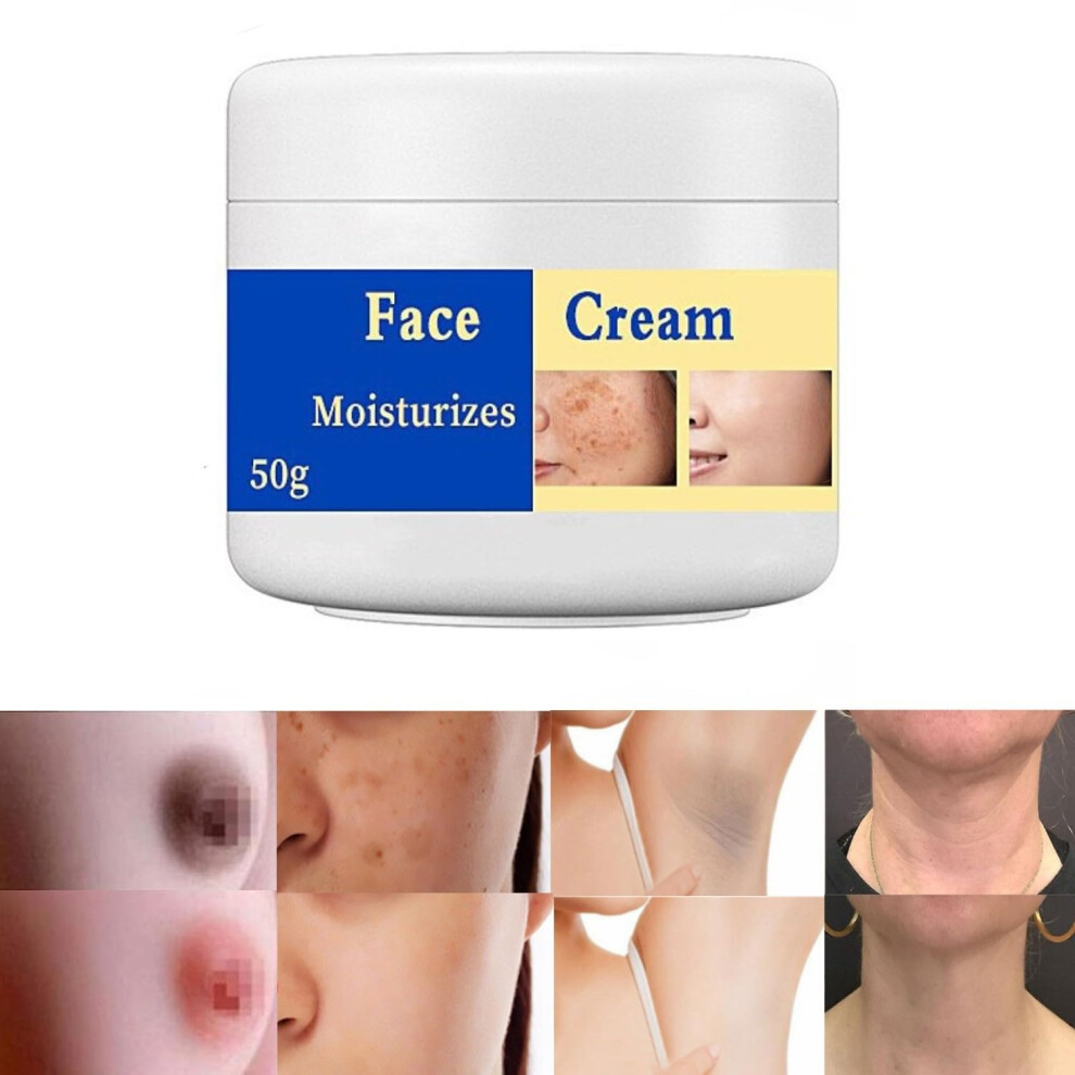 Dark/Cream Spot Remover With Collagen And Hyaluronic Acid For Face And Body, 50G Moisturizer
