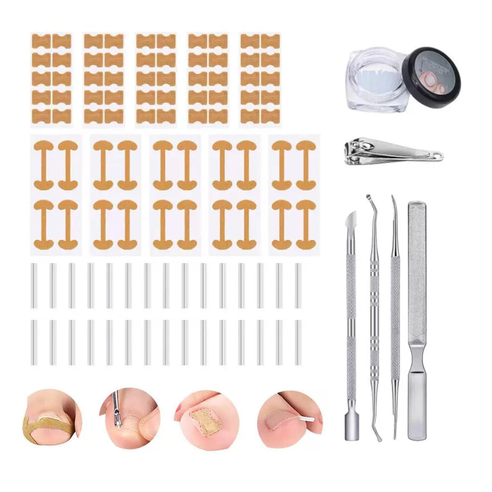 Ingrown Toenail Corrector Kit with Painless Correction Strips and Pedicure Tools for Men and Women