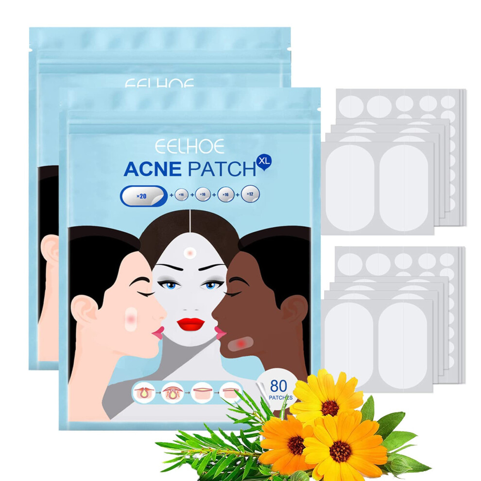 Acne Pimple Patch with Tea Tree and Calendula, Hydrocolloid Invisible Cover, 5 Sizes 160 Count 2 Pack