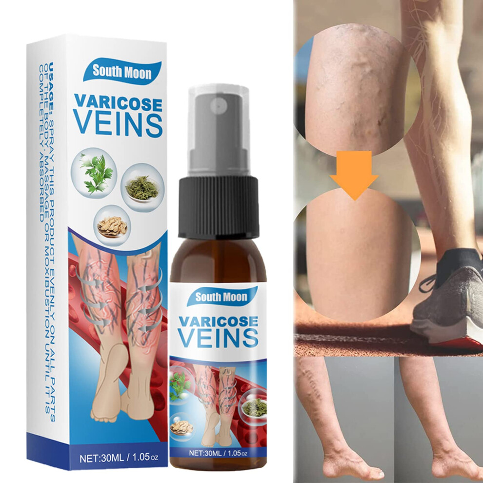 Varicose Veins Treatment Spray for Legs and Feet, Reduce Visible Veins, Improve Circulation 1PCS