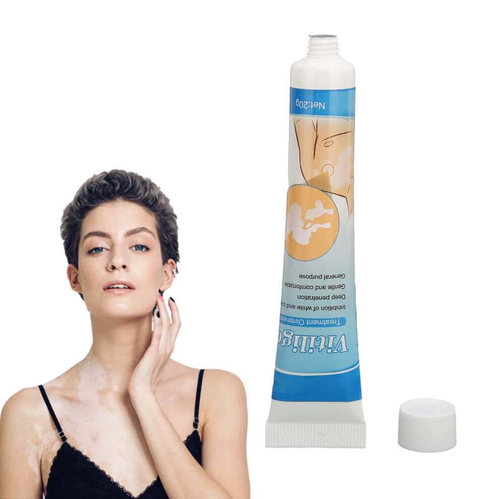 Cream Vitiligo Treatment With Gentle Herbal Formula For Skin Pigmentation 20G
