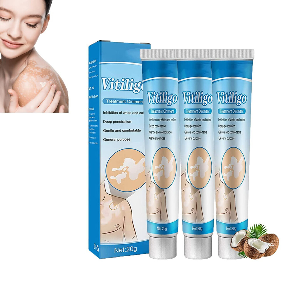 Cream Vitiligo Treatment 20G Herbal Formula For Pigmentation Balance And Skin Care 3Pcs