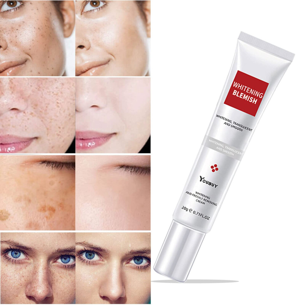 Dark/Cream Spot Remover For Face With Instant Results, Melasma And Freckle Removal, 0.71Fl.oz