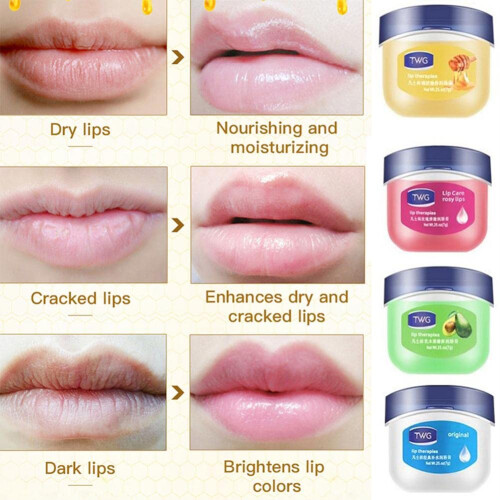 Fruit Flavored Lip Balm Set with Deep Hydration and Anti Chapping Protection, Mini 1