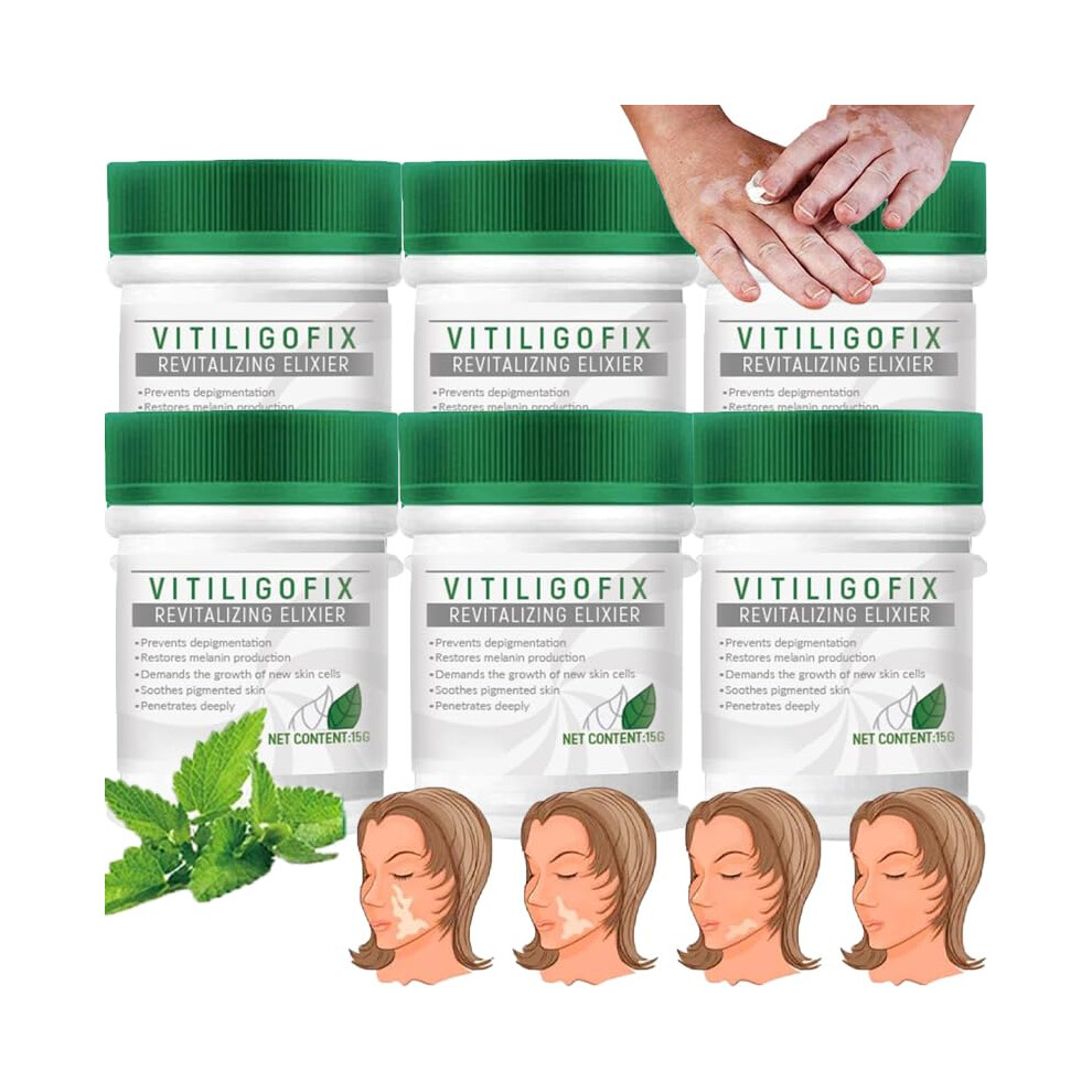 Cream Vitiligo Treatment 15G 6Pcs With Pigmentation Balance And Deep Hydration For Face And Body