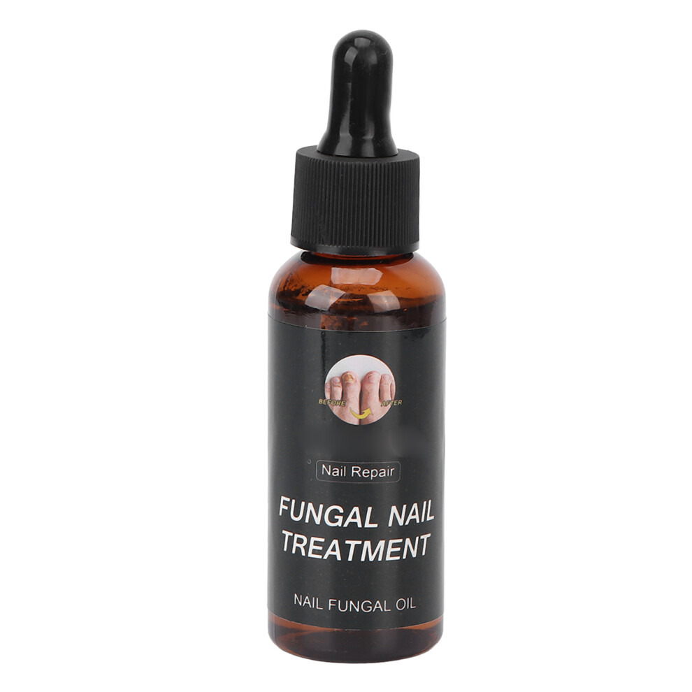 Gentle Nail Repair Oil For Toenail Fungus Treatment, Healthy Nail Renewal Formula With Natural Ingredients And Soothing Relief Properties, Sturdy Mat