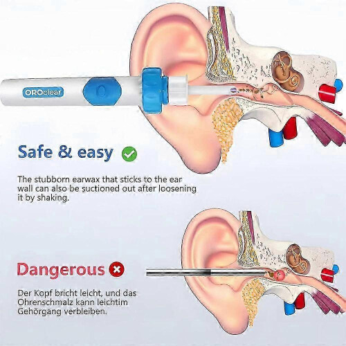 Oroclear Earwax Remover Ηλεκτρικό καθαριστικό αυτιών με αναρρόφηση κεριού 2
