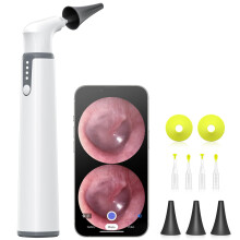 Wireless Otoscope with Camera and Light, Stable Gyroscope View, Dual Display, Ear Wax Removal Tool for Adults Kids Pets, for iPhone and Android