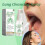 (2pcs)Lung Cleansing Spray, 30ML Advanced Lung Cleansing Spray, Lung Spray, Herbal Lung Cleansing Spray, Powerful Lung Support, Daily Use 2