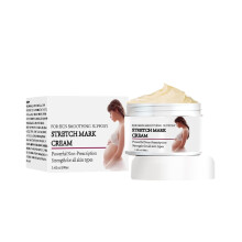 Stretch Mark Cream for Pregnancy and Weight Loss, Fast Absorbing and Deep Hydration for Skin