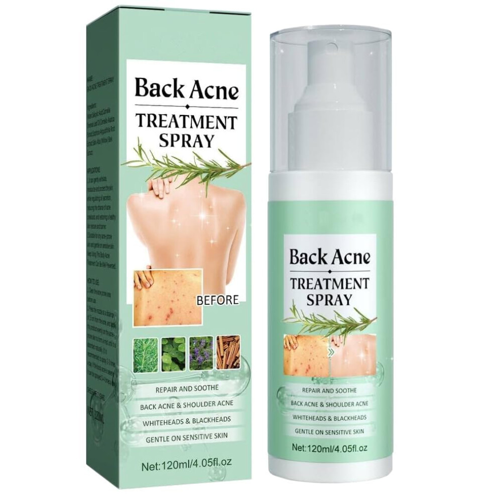 White Back Acne Spray With 2% Salicylic Acid And Tea Tree Oil, Herbal Formula Body Acne Solution,