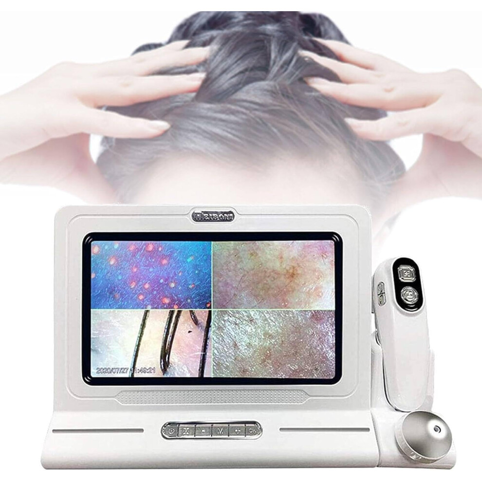 Scalp And Hair Follicle Analyzer With 11 Inch Hd Display, 50X 200X Dual Lens Hair And Skin Scanner White 9450606962645