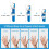 Finger Companion, Ακινητοποίηση Δακτύλων που Εξασφαλίζει Σωστή Ευθυγράμμιση, 3