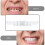 Σετ τεχνητών δοντιών Smile Snap On, άνω και κάτω οδοντιατρικές όψεις, οδοντοστοιχίες 5